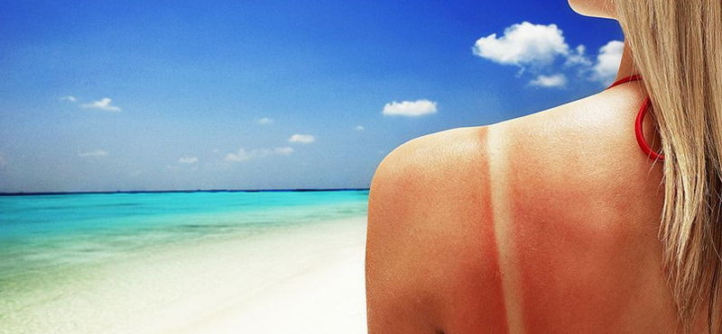 Kako nevarni so sončni žarki?