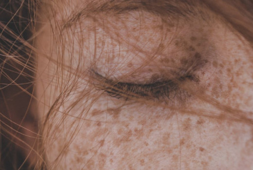 Hialuronska kislina za zdravje