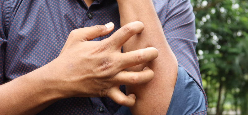 Črevesni mikrobi in histamin