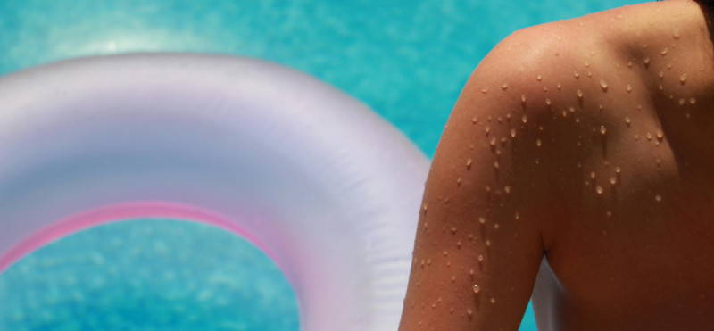 SOS za opečeno kožo